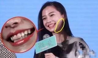 杨颖有没有整容 杨颖有没有整容